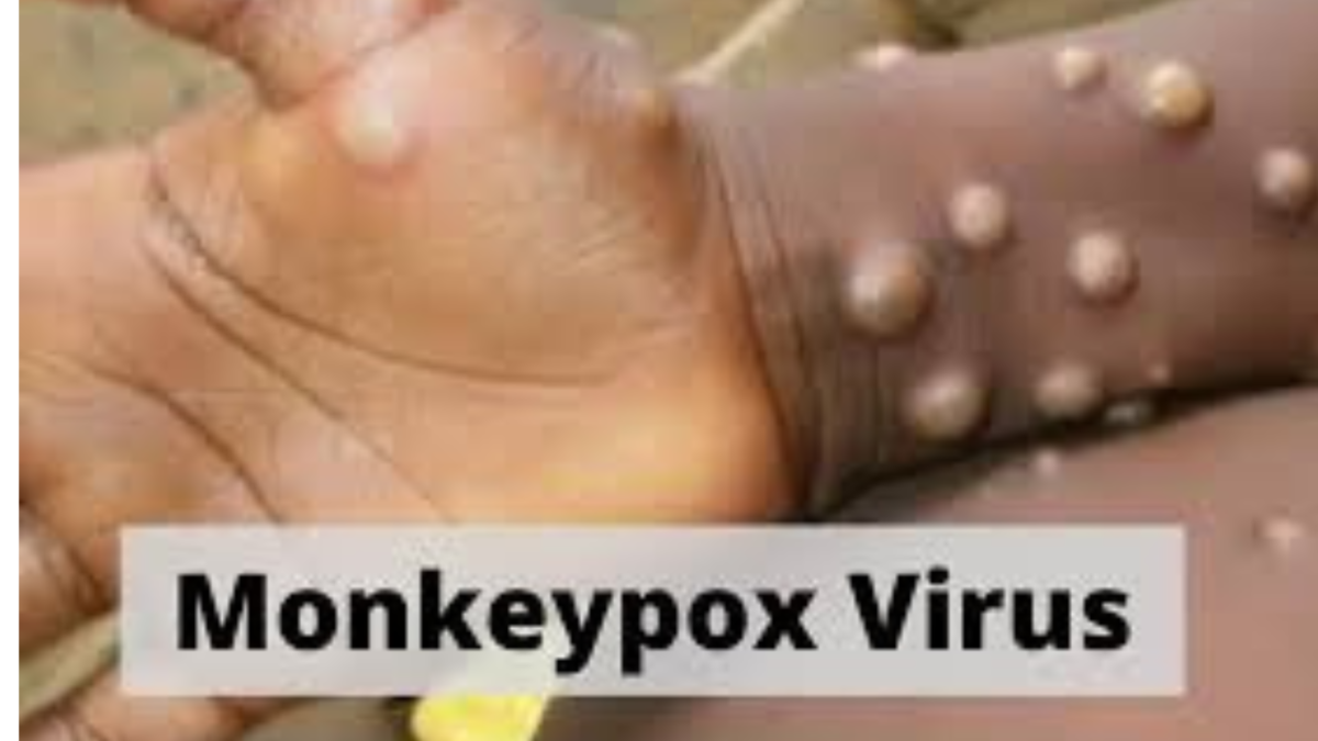 All You Need To Know About The Monkeypox Disease